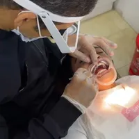 Detartraje + profilaxis