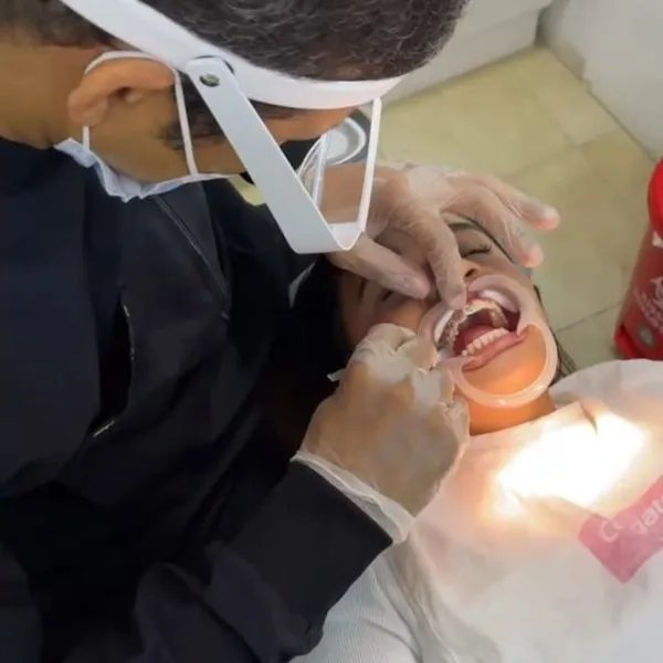 Detartraje + profilaxis